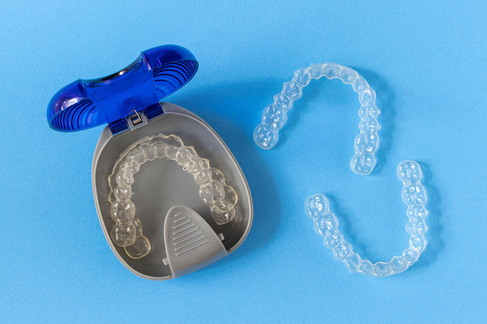 5 Reasons to Choose Clear Braces