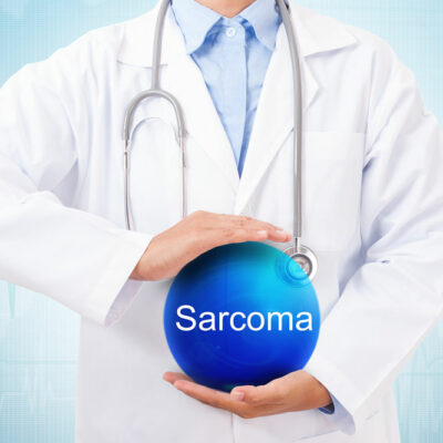 5 Risk Factors for Sarcoma