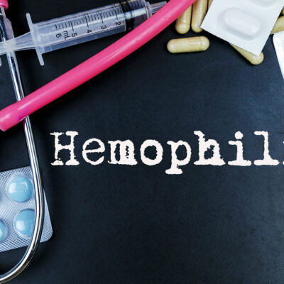 Severity Levels and Early Signs of Hemophilia