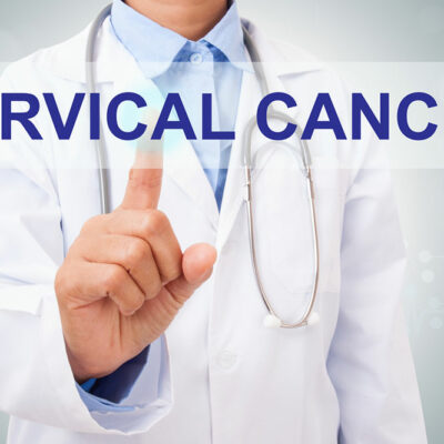 Various Treatment Options for Cervical Cancer