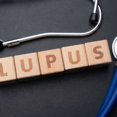 5 Warning Signs of Lupus and Medical Treatments